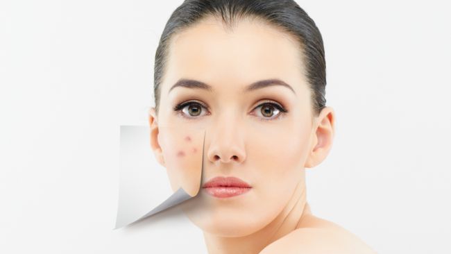 7 cauze neobişnuite care îţi pot cauza acnee tardivă