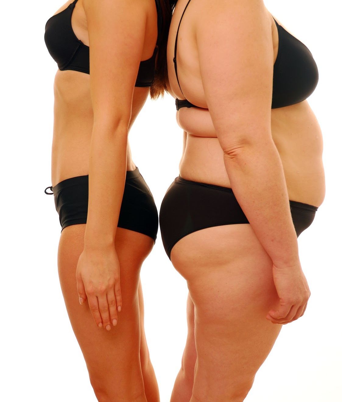SĂNĂTATE. Plusurile şi minusurile abdominoplastiei
