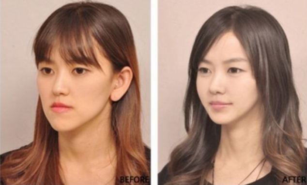 OPERAŢIILE ESTETICE din Corea de Sud: atât de BUNE, încât PACIENŢII trebuie să  dovedească cine sunt