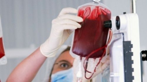 EFECTUL MIRACULOS al TRANSFUZIILOR de SÂNGE asupra creierului 