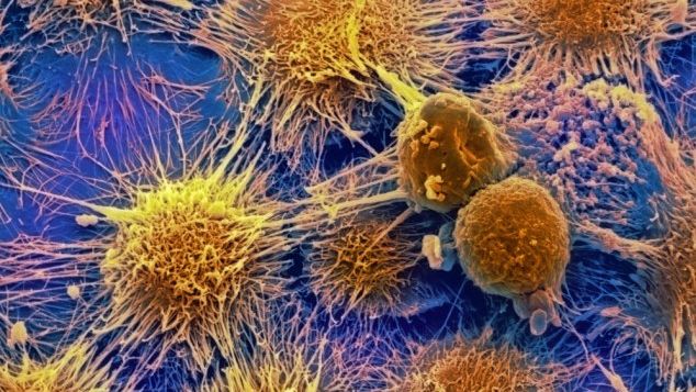 Cercetătorii: Cancerul "nu va fi, probabil, niciodată complet eradicat" 