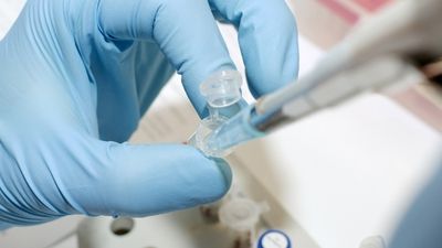 Companii farmaceutice japoneze testează tratamente pentru cancer pe baza datelor genetice