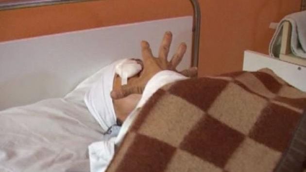 CUTREMURĂTOR. O femeie, DESFIGURATĂ de propriul soţ. Are nevoie 180 de zile de îngrijiri medicale