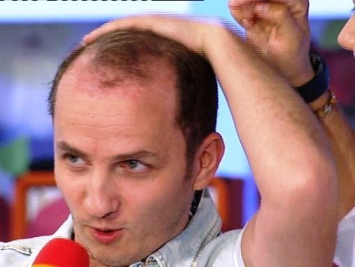 Cum arata Mihai Trăistariu la un an și jumătate de la implantul de păr? Nimeni nu-l mai recunoaște!