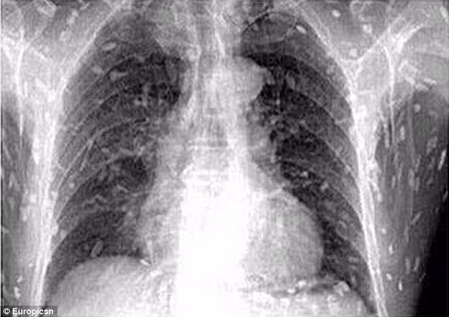 Acuza dureri de stomac şi a mers la doctor pentru un control de rutină. Ce a aflat este cutremurător