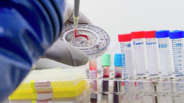 TEST RAPID pentru depistarea EBOLA