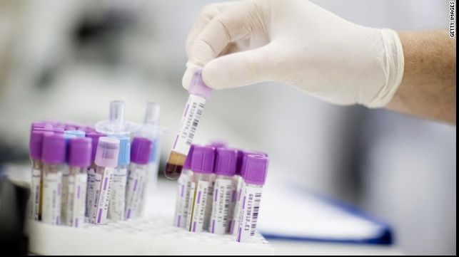 TESTUL care îţi spune dacă ai CANCER