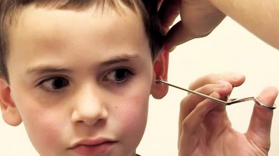 Credea că are un creion înfipt în ureche, însă medicul a rămas şocat când a văzut ce e de fapt