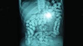 Cum au ajuns botoșănenii plecați la muncă în construcții să transporte droguri în stomac