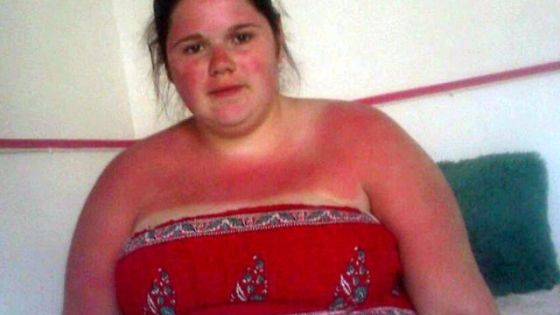 Râdeau de ea pentru că era obeză. A slăbit spectaculos şi le-a dat tuturor o lecţie de viaţă
