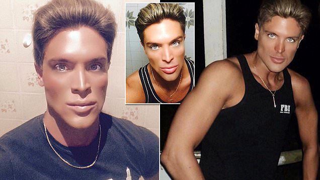 Transformarea lui o să te şocheze! Şi-a făcut opt operaţii estetice că să arate aşa!