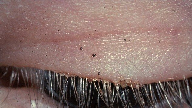 Diagnostic socant pentru o tanara dupa un simplu consult oftalmologic