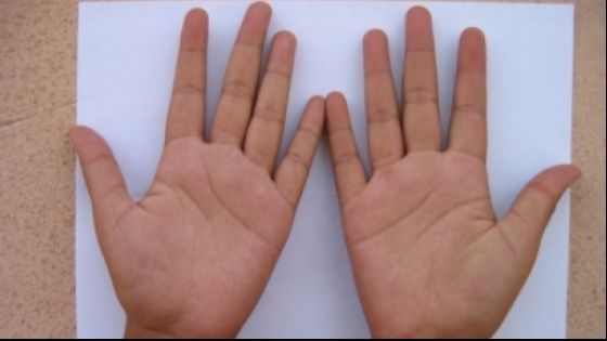 Testul simplu care îţi spune dacă vei face cancer. Trebuie doar să fii atent la degetele tale