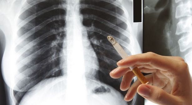 Alimentul minune care ne apără plămânii dacă îl consumăm în mod regulat