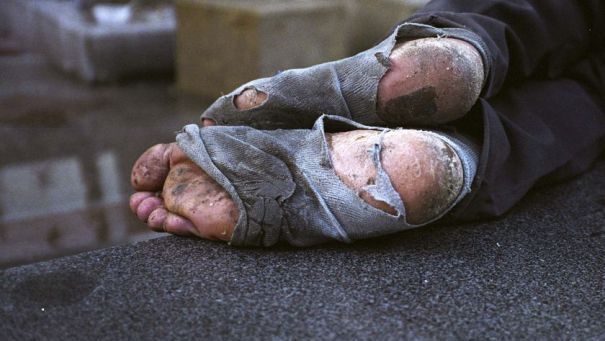 New York Times scrie despre cerşetorul român din Suedia mutilat cu clor pe faţă, în timp ce dormea