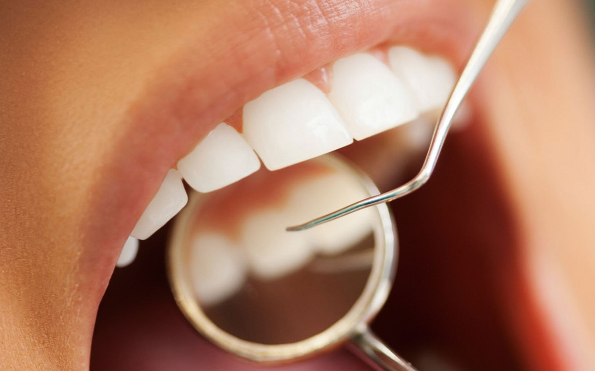 Prototipul care scoate durerea din cabinetul dentistului