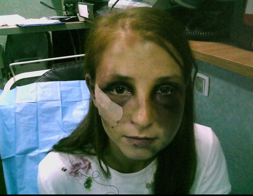 "M-a bătut 22 de ore şi nu am putut să mă apropii de telefon". Tânăra face mărturii şocante
