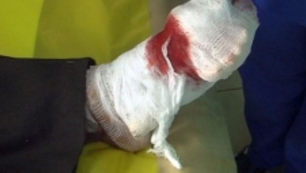 Incredibil: şi-a înfăşurat un ficat de porc în jurul piciorului şi a ieşit la cerşit