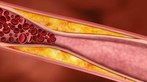 Descoperire surprinzătoare. Un singur fruct scade colesterolul la fel de rapid ca medicamentele
