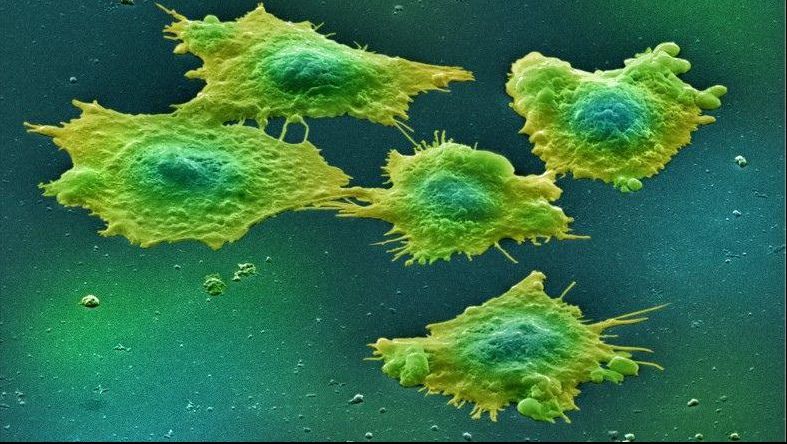 S-a descoperit: alimentul acesta provoacă patru tipuri de cancer. Renunţi la el?