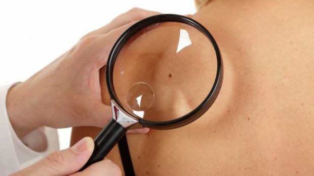 Ce NU se ştia despre cancerul de piele: e mai PERICULOS decât se credea!