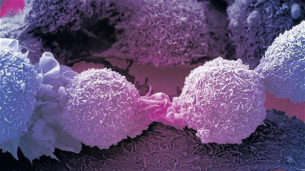 Alimentul care ajută la apariția cancerului. Îl mâncăm zilnic