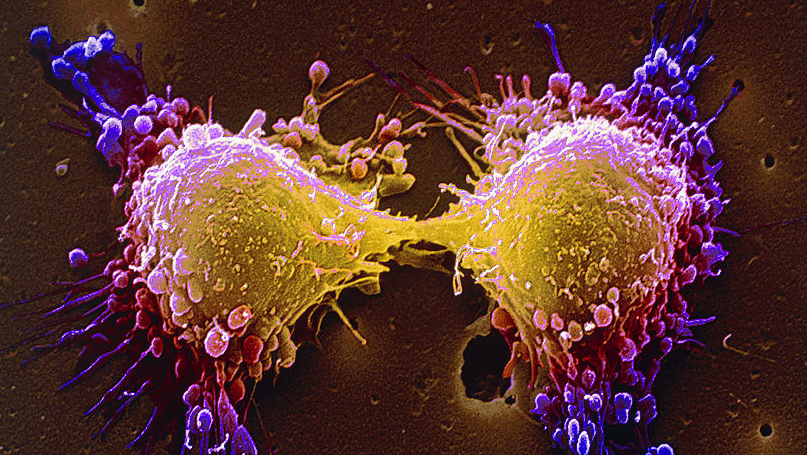 4 lingurițe din acest amestec vindecă cancerul