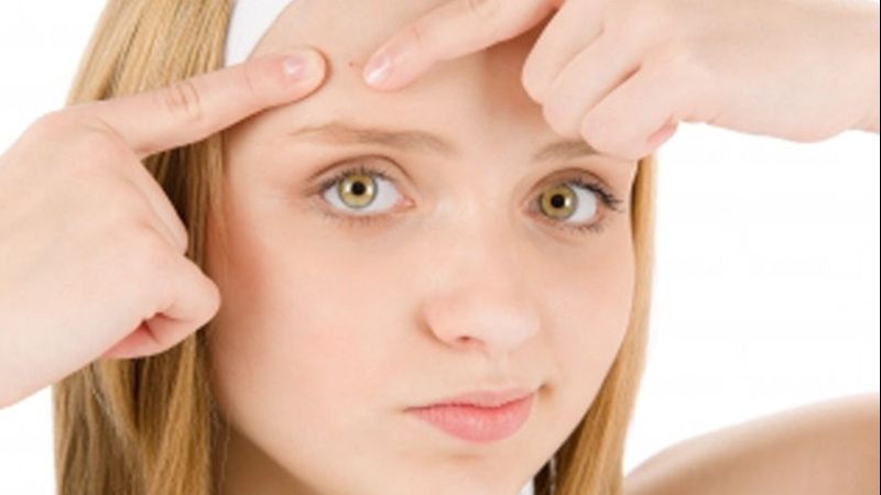 5 produse care chiar au reuşit să vindece rapid acneea