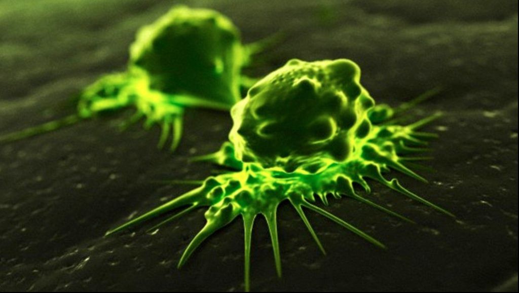 Cancerul la colon poate fi învins cu ajutorul unui singur aliment miraculos. Îl ai și tu în casă