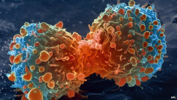 Avea cancer pulmonar și credea că va muri. S-a vindecat cu aceste două ingrediente