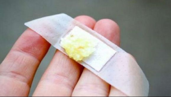 A pus usturoi pe un plasture și l-a lipit pe piele. După 2 săptămâni ceva uimitor s-a întâmplat