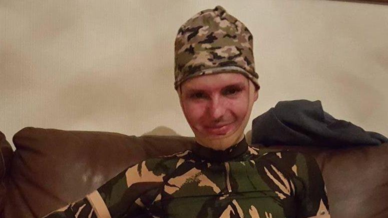 Mesajul dur al unui supravieţuitor din Colectiv, tratat în Anglia:"Diferența dintre viață şi moarte"