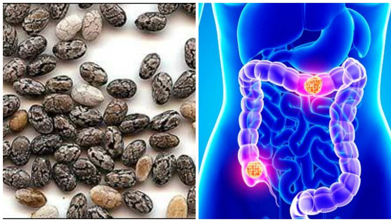 Probabil cel mai bun remediu natural pentru cancerul de colon. Din păcate, puțină lume îl știe
