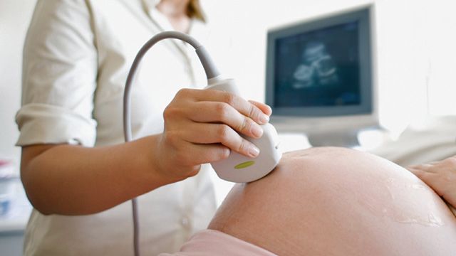 Medicul a asigurat-o că gemenii ei sunt bine. La naștere, a încremenit când a văzut monstruozitatea