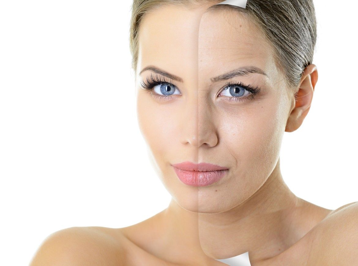 Metodă extremă de îndepărtare a cearcănelor. E nebunie curată!