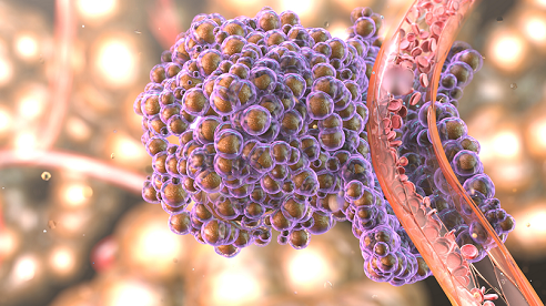 Alimentul care răspândește cancerul în tot corpul. Renunță la el cât mai rapid