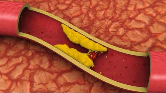 Alimente care ţin colesterolul sub control