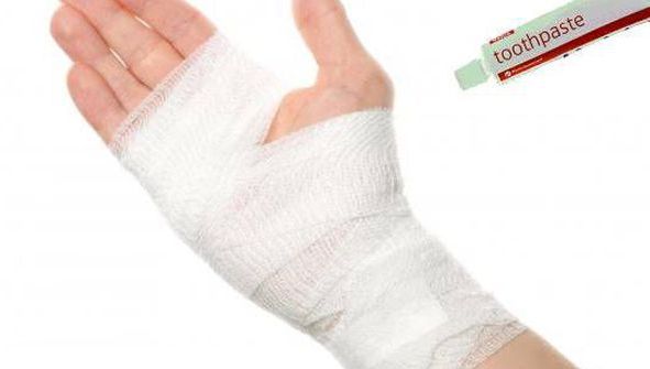 Şi-a aplicat pastă de dinţi pe mână, apoi a acoperit cu tifon. Motivul este uimitor!