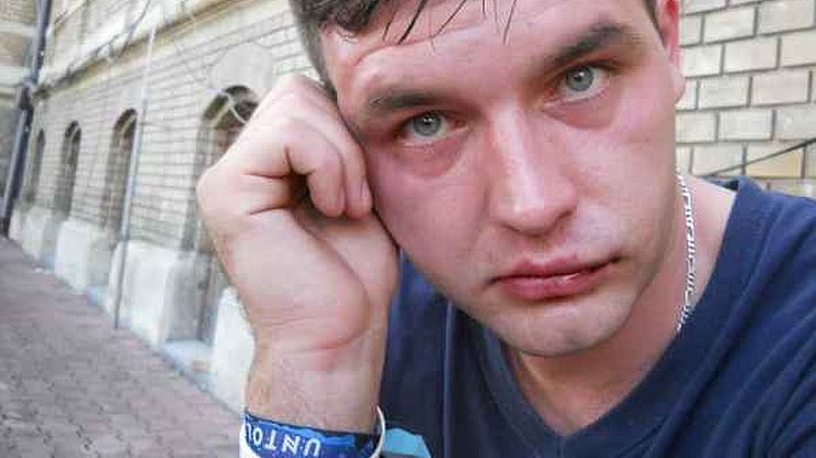 Incident violent la UNTOLD. Un tânăr, bătut cu bestialitate în faţa agenţilor de pază