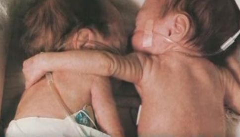 O nou-născută şi-a îmbrăţisat sora geamănă care era pe moarte. Ce a urmat a şocat lumea medicală!
