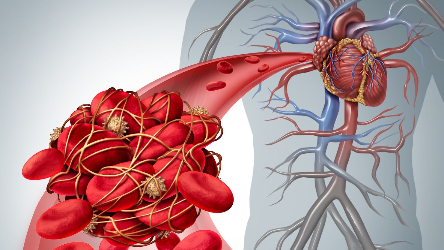 Semne că ai un cheag de sânge care a ajuns la inimă sau la creier. Mergi de urgență la medic!