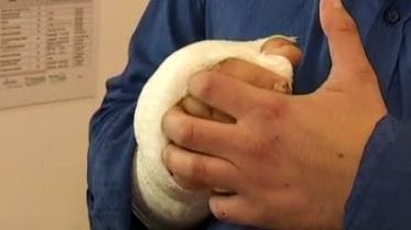 Un mare muzician, operat. S-a accidentat la mână, după ce a sărit pe fereastră 