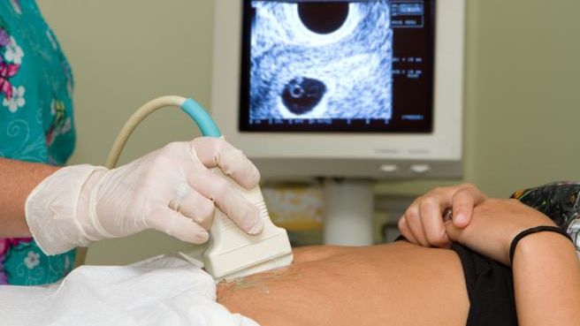 „Boala femeilor neiubite” afectează femeile cu vârste între 15 şi 50 de ani. Iată cum o recunoşti!