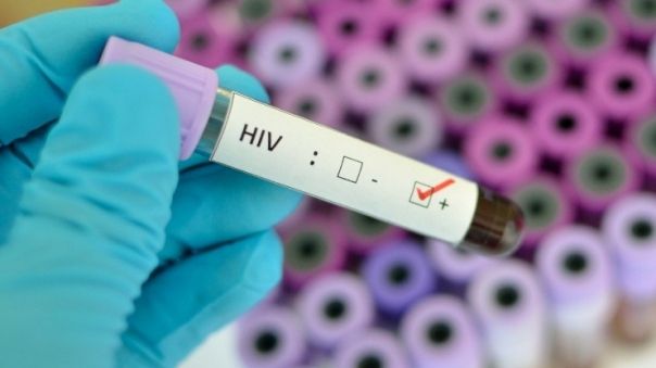 Primele simptome ale infecției cu HIV. Nu le ignora!