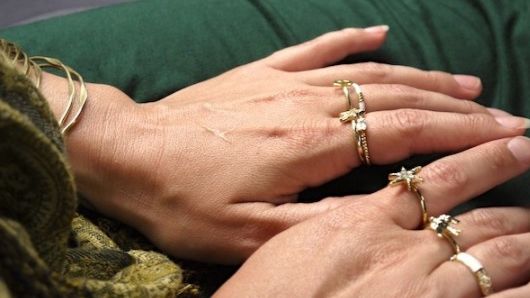 Şi tu porţi bijuterii de aur? Boală curată pentru trei organe vitale