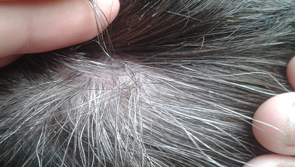 Incredibil! Ai aşa ceva în păr? Nu o să faci cancer niciodată!