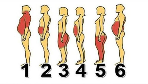 Identifică-ţi tipul de obezitate pentru a scapa rapid de kilogramele în plus