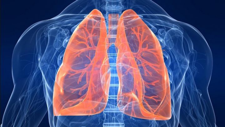 Ai aceste simptome? Ar putea fi cancer pulmonar