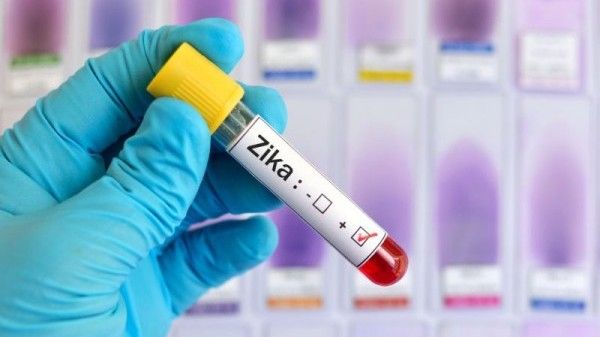Anunţ îngrozitor despre virusul ZIKA!