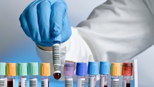 Ai aceste simptome? Mergi urgent la doctor! Este infecţie cu streptococ